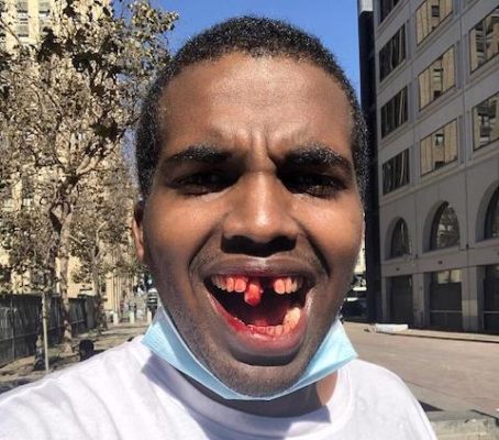 Black-Team_Save_America_event_organizer_Philip_Anderson_gets teeth punched out by Antifa BLM