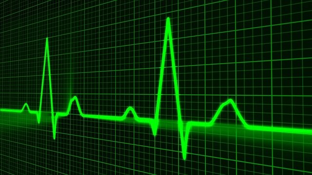 pulse ekg heart rate