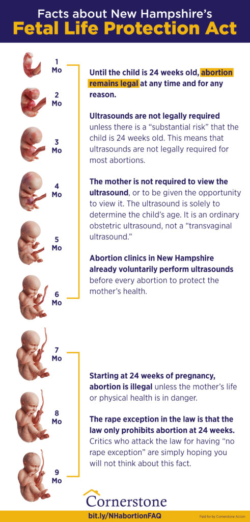 Fetal Life Protection Act infographic - Cornerstone