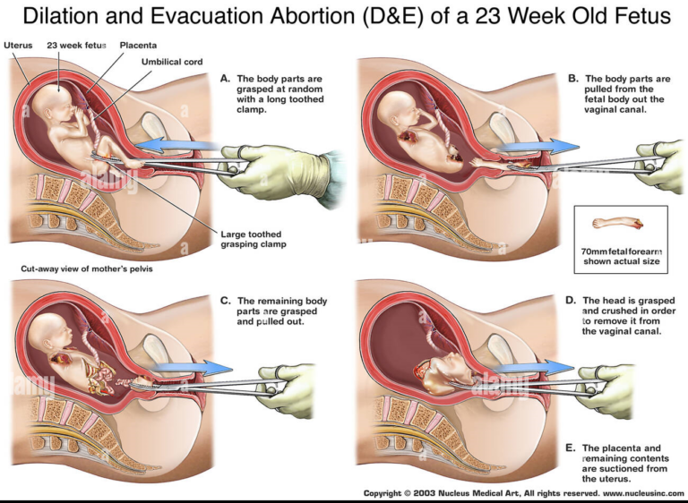 Downloaded from https://twitter.com/prolife_lgbtq/status/1499425913263599617/photo/1 on 4/23/22